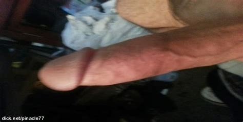 My Huge 9 Inch Cock Photo Album By Pinacle77
