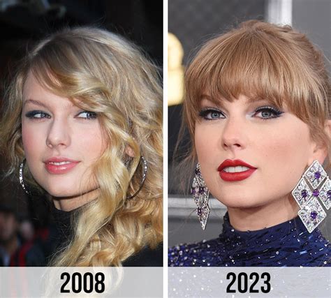 Did Taylor Swift Get Plastic Surgery Over The Years A Plastic Surgeon