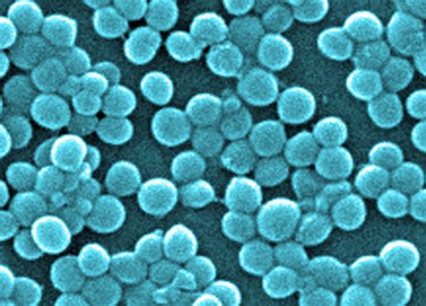 Invasive Staphylococcus Aureus Surveillance University Of Rochester