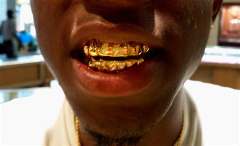 Solid Gold Teeth