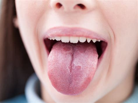 9 Surprising Secrets Your Tongue Can Reveal About Your Health Reader