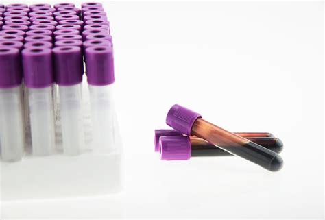 Premium Photo Edta Blood Tube For Cbc Test In Laboratory
