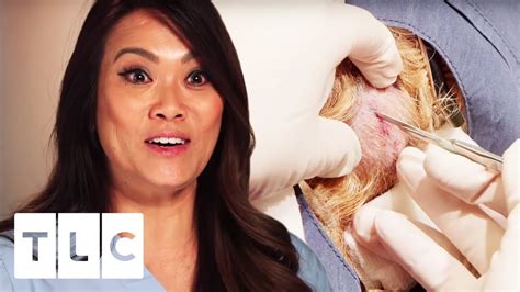 A New Dr Pimple Popper