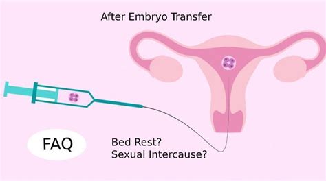 Dos And Donts After Embryo Transfer By Ivf Specialist Doctor By
