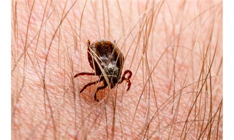 Lyme Disease Symptoms Treatment Diagnosis Health