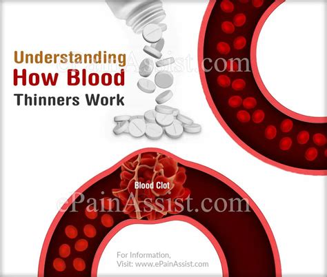 Types Of Blood Thinners