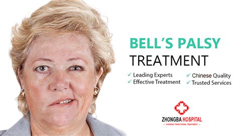 Pin By Zhongba Hospital Lahore On Physiotherapy Hospital Treatment Bells Palsy Physiotherapist