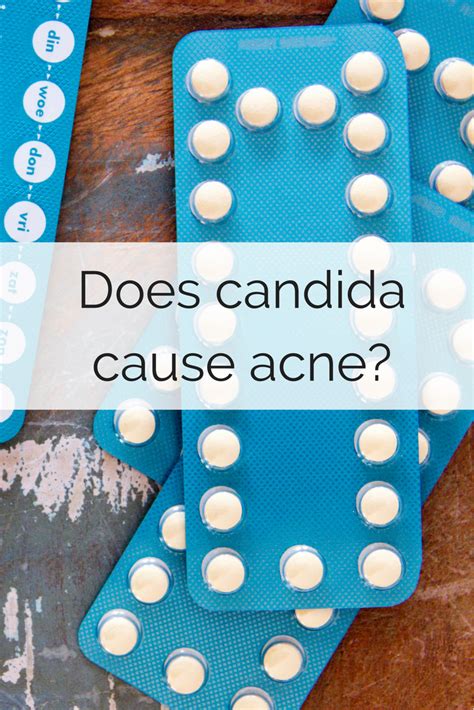Does Candida Cause Acne What You Need To Know Acneclearing