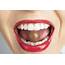 That Sweet Tooth You’ve Got Causes Cavities  Catonsville Dental Care