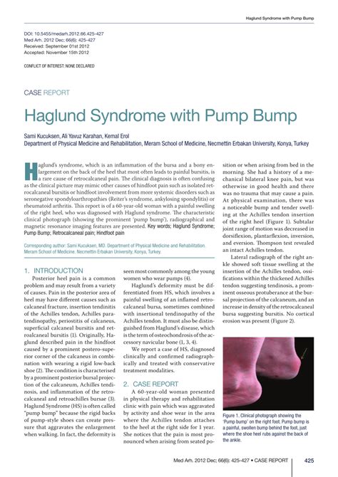 Haglund's syndrome is group of symptoms namely haglund's deformity (exostosis of lateral calcaneum) with retrocalcaneal bursitis.1 it is often accompanied by achilles tendinitis. (PDF) Haglund Syndrome with Pump Bump