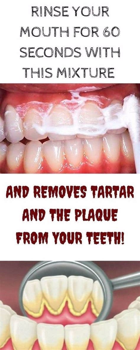how to get rid of tartar with one simple ingredient health and diy ideas