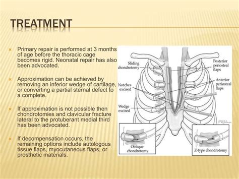 Congenital Chest Wall Anomalies Ppt