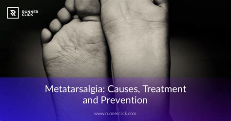 Metatarsalgia Ball Of The Foot Pain Causes And Treatments