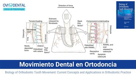 BiologÍa Del Movimiento Dental En Ortodoncia Conceptos Y Aplicaciones