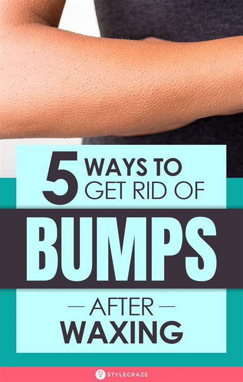 5 Home Remedies To Get Rid Of Bumps After Waxing In 2020 Waxing Tips