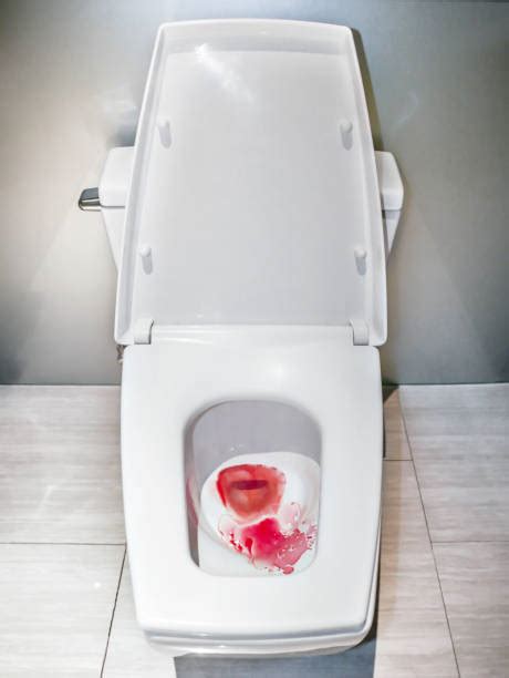 Bloody Stool Stock Photos Pictures And Royalty Free Images Istock