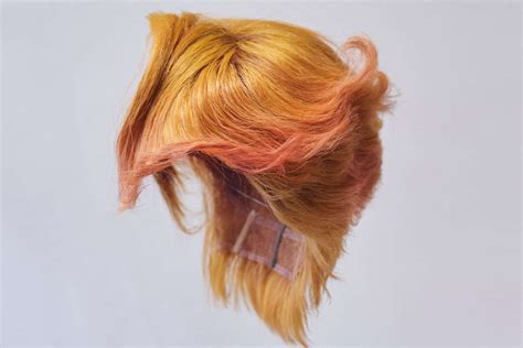 La greffe de cheveux prend chez les jeunes : « J’ai repris confiance en