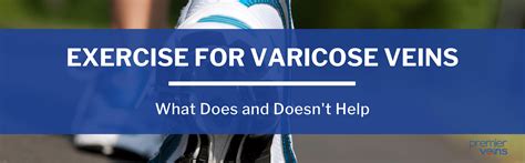 The Benefits Of Exercise For Varicose Veins