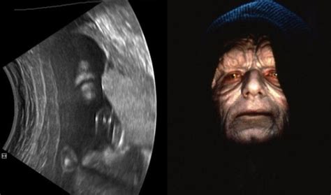 Ultrasound Image Of Baby Emperor Palpatine Goes Viral Lifesite