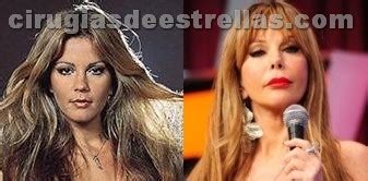 Check spelling or type a new query. Antes y Después del bisturí,impresionante !! - Salud y ...