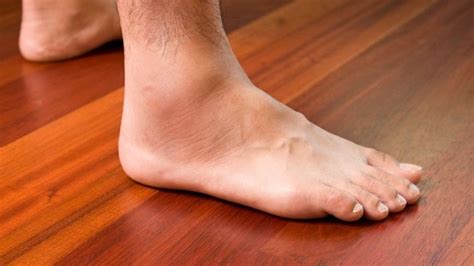 Top Effective 16 Ways To Get Rid Of Swollen Legs Ankles And Feet