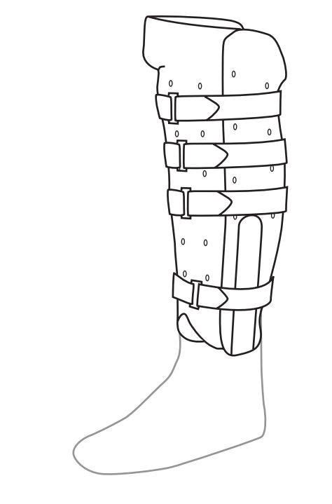 Orlando Tibial Fracture Brace All Fracture Bracing Lower Limb