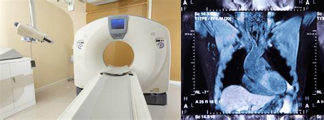Computed Tomography (CT) Medical X-Ray Imaging | Open Medscience