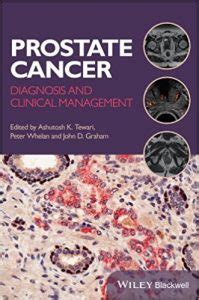 The stage of the cancer will determine which types of treatments will be necessary. Prostate Cancer: Diagnosis and Clinical Management 1st ...