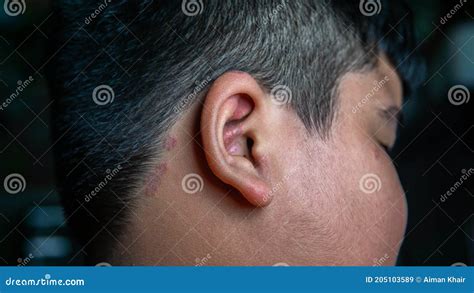 Itchy Earlobe Stock Photos Free And Royalty Free Stock Photos From