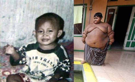 Meet World Fattest Boy Arya Permana दुनिया का सबसे मोटा बच्‍चा 192