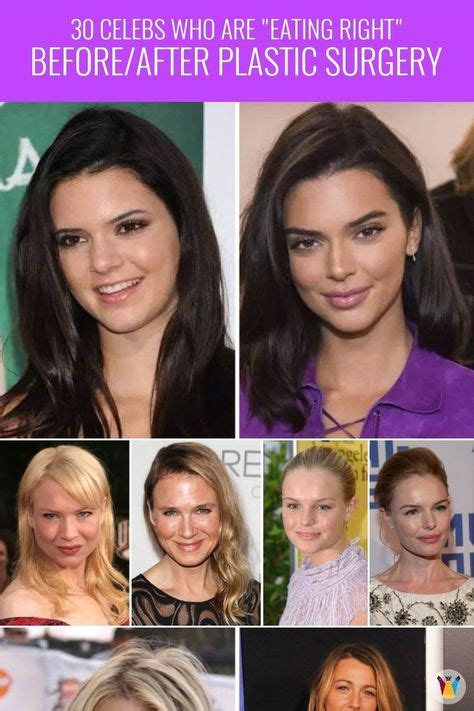 Stunning Transformations Of Famous Celebrities After Plastic Surgery