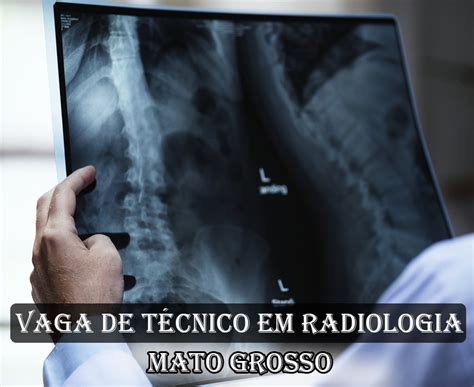 DICAS DE RADIOLOGIA Tudo Sobre Radiologia VAGA PARA TÉCNICO EM RADIOLOGIA BARRA DAS GARÇAS MT