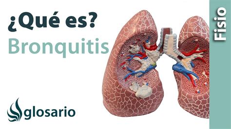 Bronquitis Qu Es Qu Estructuras Afecta S Ntomas Signos Causas Y