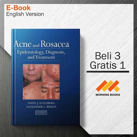 Acne And Rosacea Epidemiology Diagnosis And Treatment Morning Store