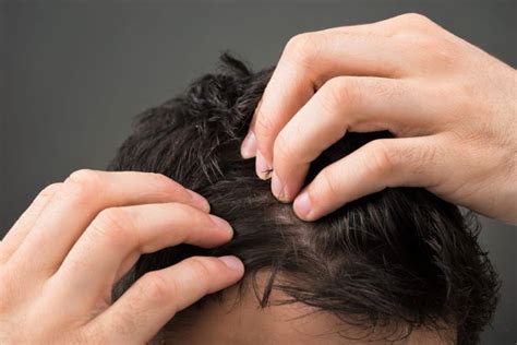 Hair loss is due to many factors 1. Does Stress Cause Hair Loss? - hair buddha