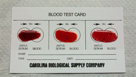 An a1c below 5.7% is normal, between 5.7 and 6.4% indicates you gestational diabetes is diagnosed using blood tests. The Ferrum College Blog: My Anatomy & Physiology Practicum