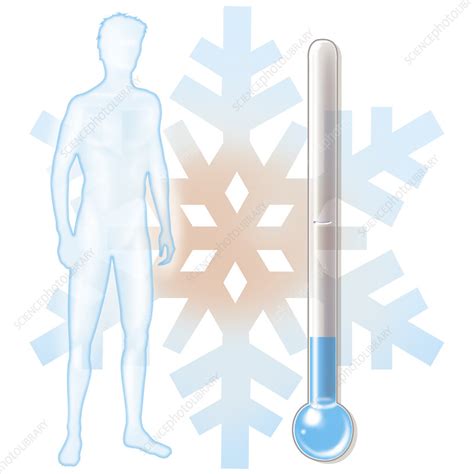 Hypothermia can be a medical emergency if the person's body temperature drops too low. Hypothermia - Stock Image - C024/4233 - Science Photo Library