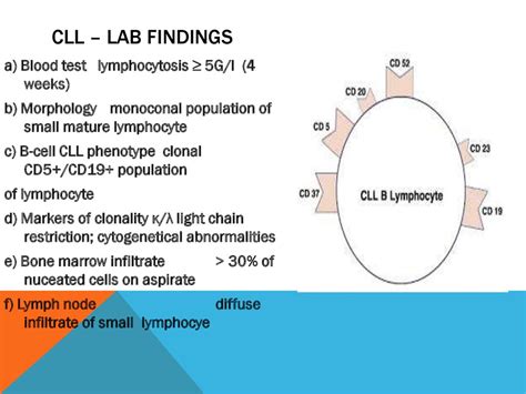 Chronic Lymphocytic Leukemia Online Presentation