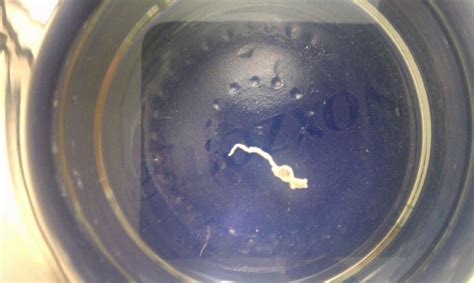 Nasal Roundworm At Parasites Support Forum Alt Med With Image