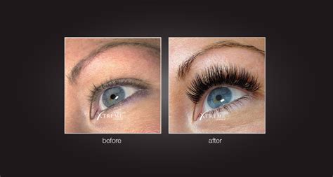 Clotrimazole is an antifungal medication that fights infections caused by fungus. Eyelash Extensions | Austin Springs Spa