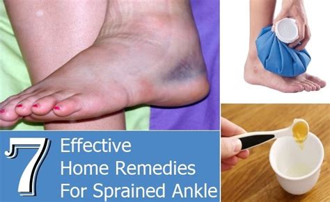 Current there is still some swelling and range of motion loss. 7 Wonderfully Effective Home Remedies For Sprained Ankle ...