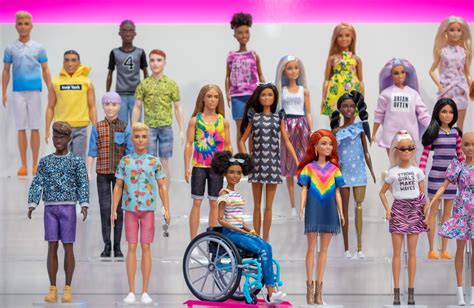 Barbie Introduces Doll With Vitiligo And Another With No Hair—why Your