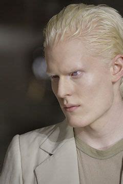 Conversamos com stephen thompson, o modelo albino que estampa o verão 2011 da givenchy gilberto junior. stephen thompson | Albino human, Albinism, Human