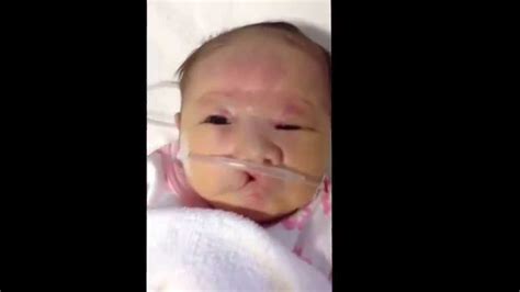 We did not find results for: 13トリソミー あみちゃん 生後24日目 Trisomy 13 Ami Day 24 - YouTube