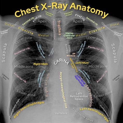 Basic Chest X Ray Interpretation Tips And Pointers To See It All