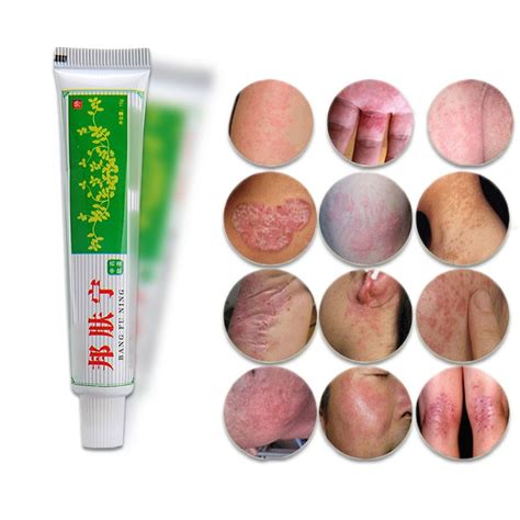 Doctorm Herbal Antibacterial Skin Itch Creams Psoriasis Eczema
