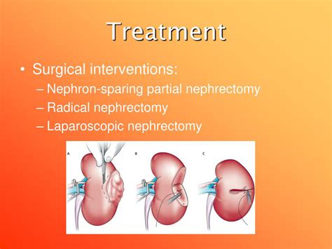 Ppt Renal Cell Carcinoma Case Study Powerpoint Presentation Free