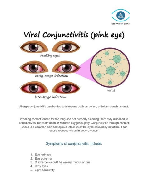 Red Eyes Causes Symptoms Treatment And Prevention