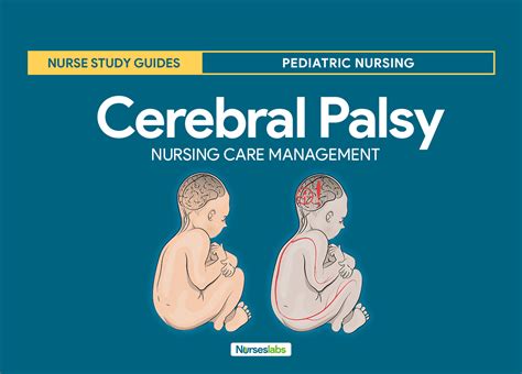 Cerebral Palsy Nursing Care Planning And Management Study Guide