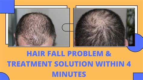 This is a hair fall treatment. Hair Fall Problem & Hair Treatment Solution within 4 ...